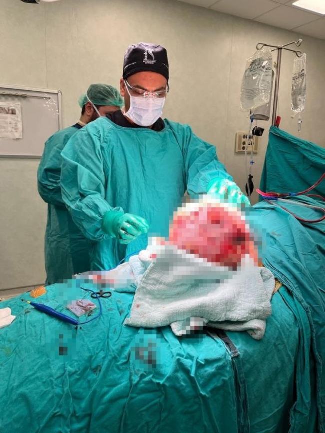 Doktorlar bile şaşkına döndü! Urfalı adamın kalçasından çıkan şoke etti