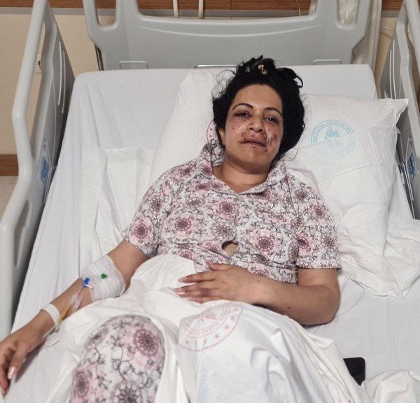 Eltisini Sokak ortasında tabancayla ağzından vurdu
