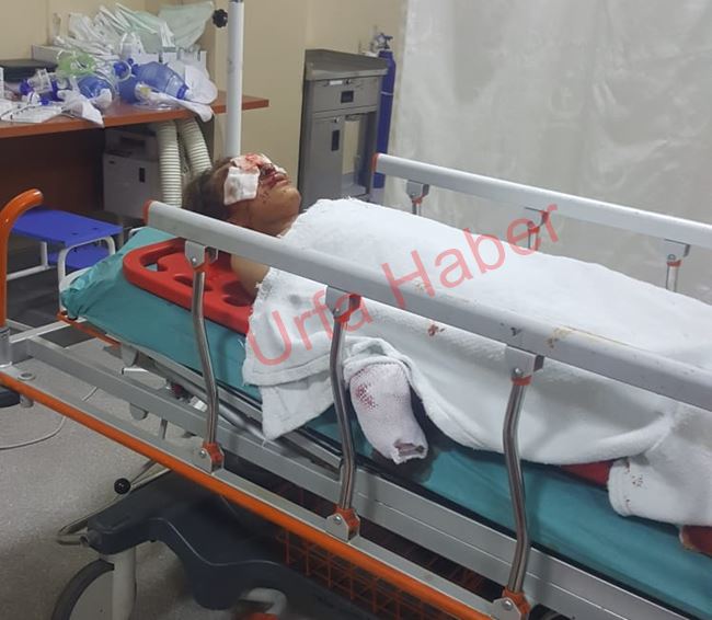GÜNCELLENDİ: Akçakale Pekmezli'de patlama