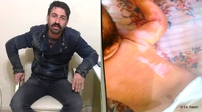 Valiliğin kararı çocuğu yanan babayı şok etti