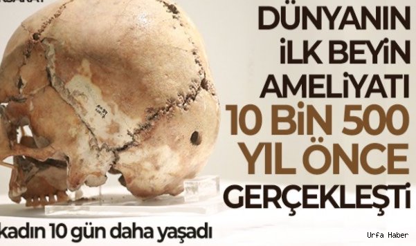Dünyanın ilk beyin ameliyatı 10 bin 500 yıl önce bakın nerede yapıldı
