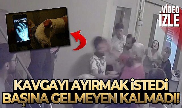 Hamile eşinin parmakları kırıldı, kendisi yumruklandı