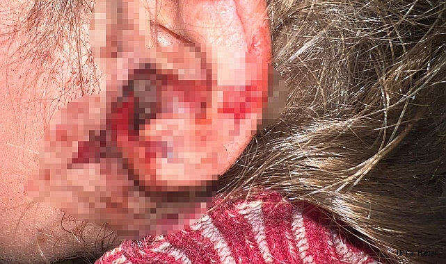 3 YAŞINDAKİ ÇOCUĞUN KULAĞINDAN  CANLI KURTÇUK ÇIKARILDI