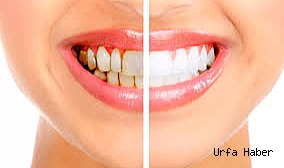 YENİ BİR YIL AĞIZ VE DİŞ SAĞLIĞINIZ İÇİN DEĞİŞİM FIRSATI OLABİLİR