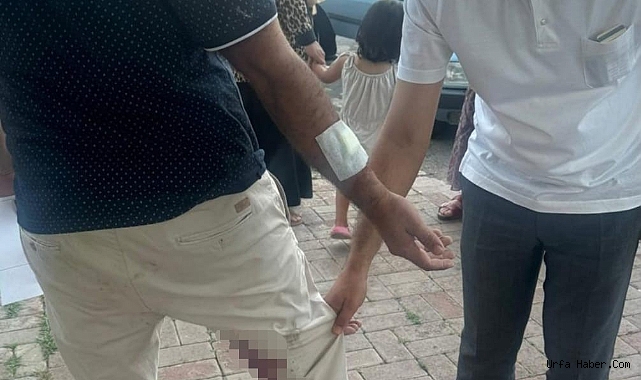 ŞANLIURFA'DA BİR VATANDAŞI ISIRAN KÖPEK KUDUZ ÇIKTI