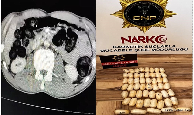 YABANCI UYRUKLU ŞAHSIN MİDESİNDEN 53 PAKET UYUŞTURUCU ÇIKTI