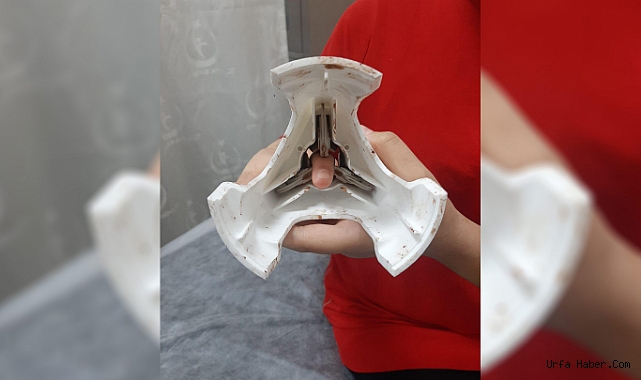 ZEYTİN ÇİZME APARATINA PARMAĞI SIKIŞAN ÇOCUK İTFAİYE EKİPLERİNCE KURTARILDI