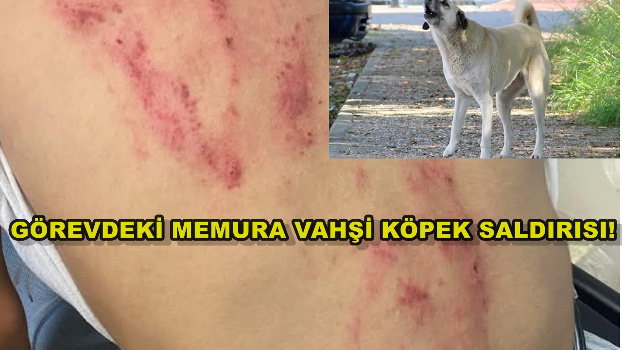 Görevdeki Memura Vahşi Köpek Saldırısı!