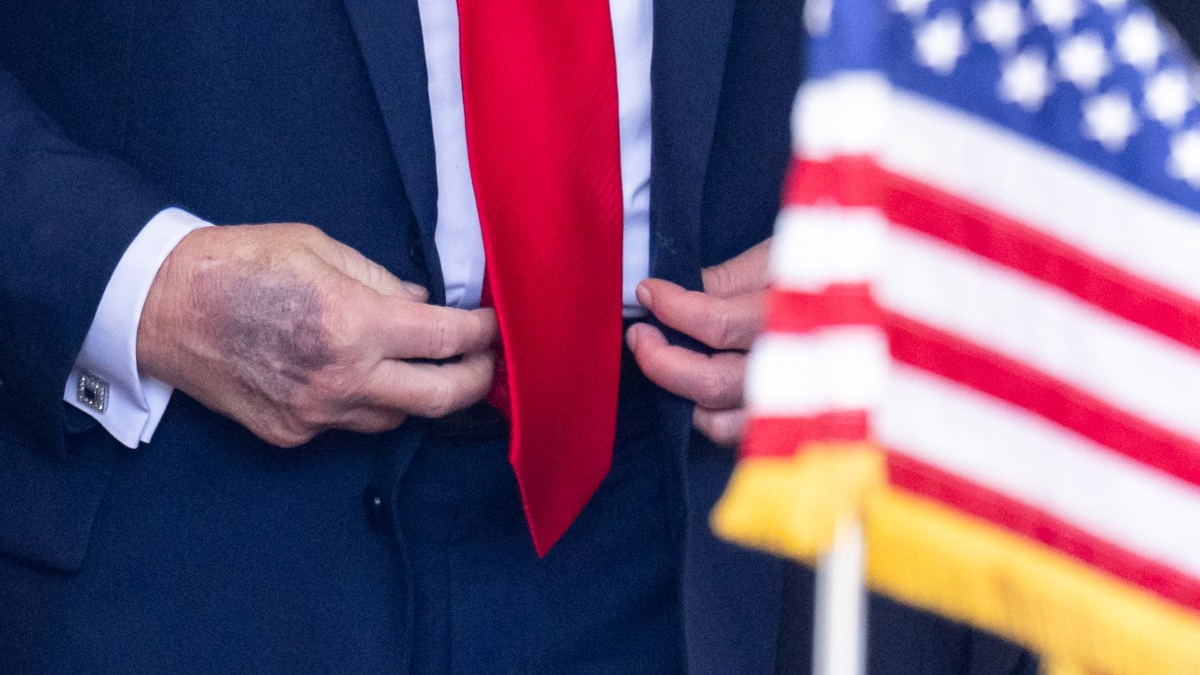Trump Ne Saklıyor? Ellerindeki Gizemli İşaretler Dikkat Çekiyor