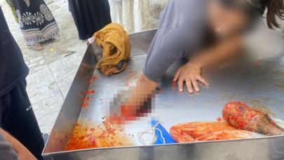 Şanlıurfa'da 3 Saatlik  Mucize Operasyon