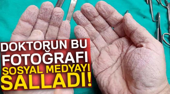 Cerrahın elleri sosyal medyayı salladı