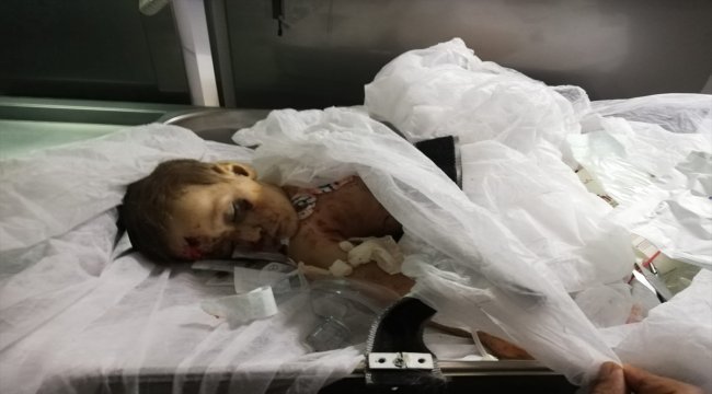9 aylık Muhammed bebek YPG/PKK'nın kurbanı oldu