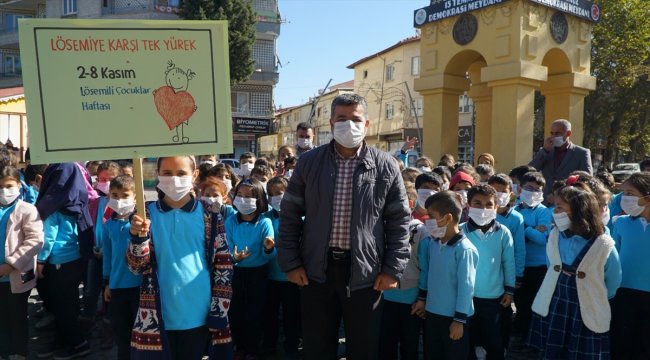 Gölbaşı'nda "Lösemili Çocuklar Haftası" farkındalık etkinliği