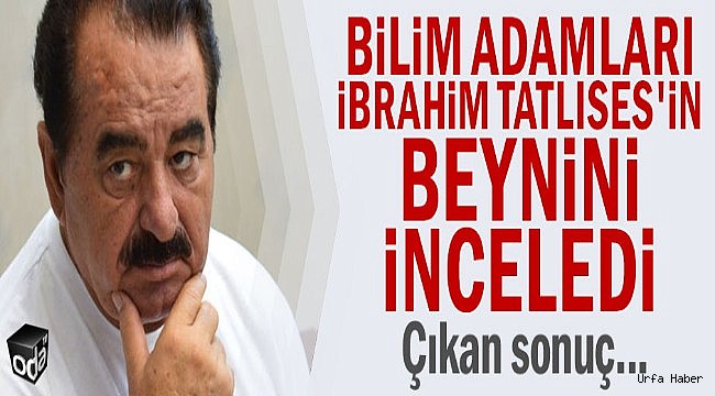 Bilim adamları İbrahim Tatlıses'in beynini inceledi