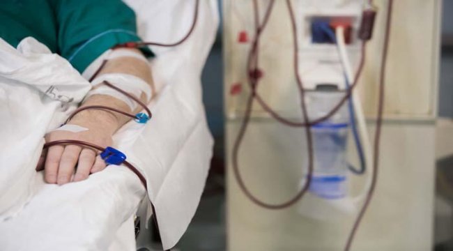 Böbrek yetmezliği Kovid-19'un seyrini ağırlaştırıyor