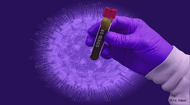 Virüsü yenen Urfalı doktordan tavsiye
