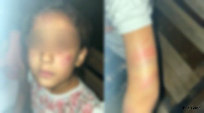 Uyuşturucu bağımlısı baba, evlatlarına işkence yaptı