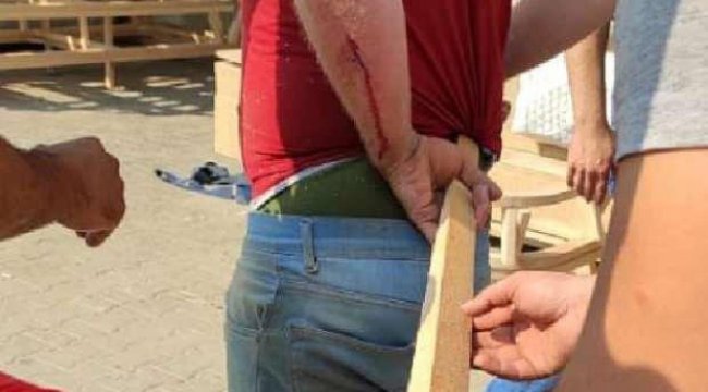 korkunç kaza! Hastaneye böyle getirildi