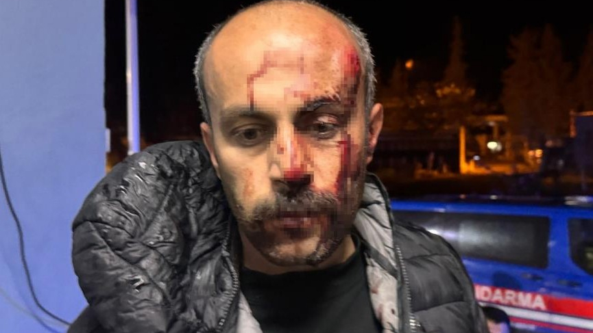 Şanlıurfa'da Trafik Kontrolünde Gerginlik