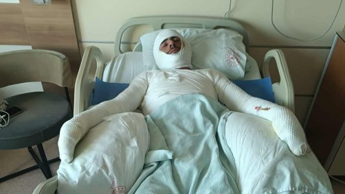 Şanlıurfa’da Tarlada Yangın Faciası: 1 Ağır 5 Yaralı