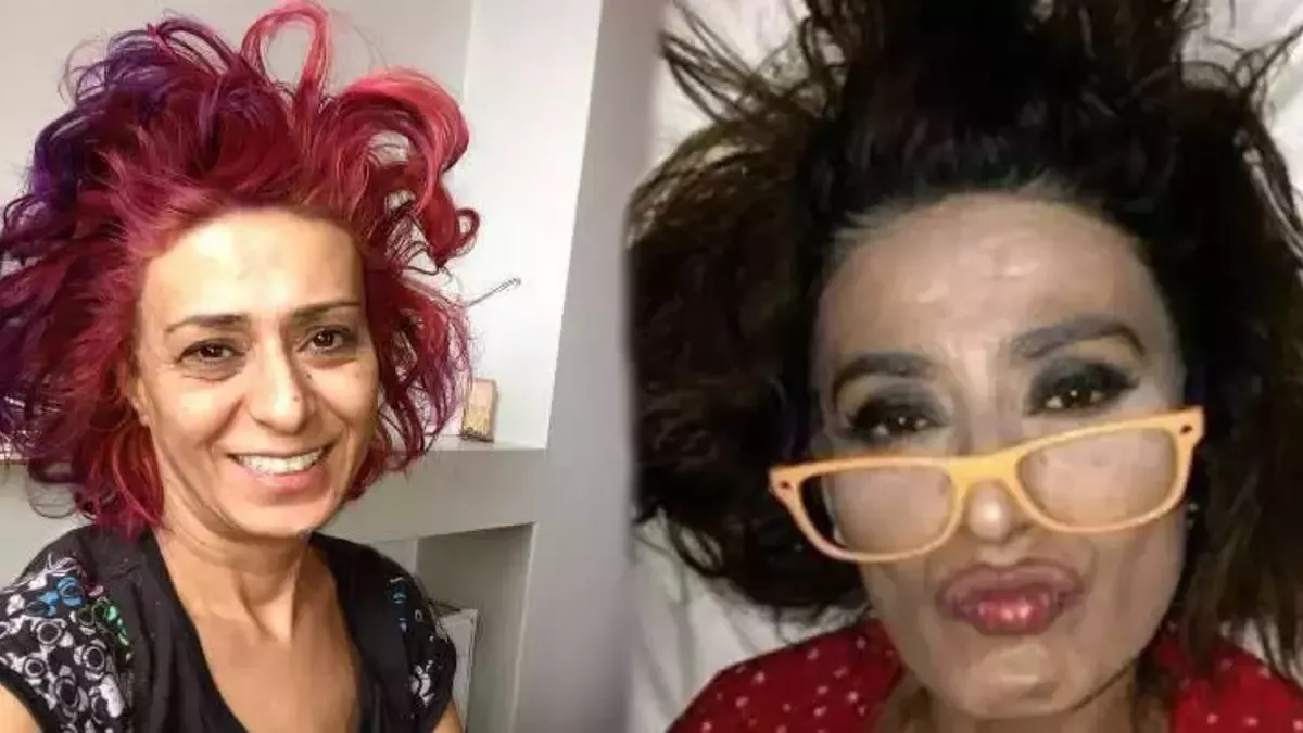 Yıldız Tilbe’den Şaşırtan İtiraf: “Yarı Baygın Geziyorum”