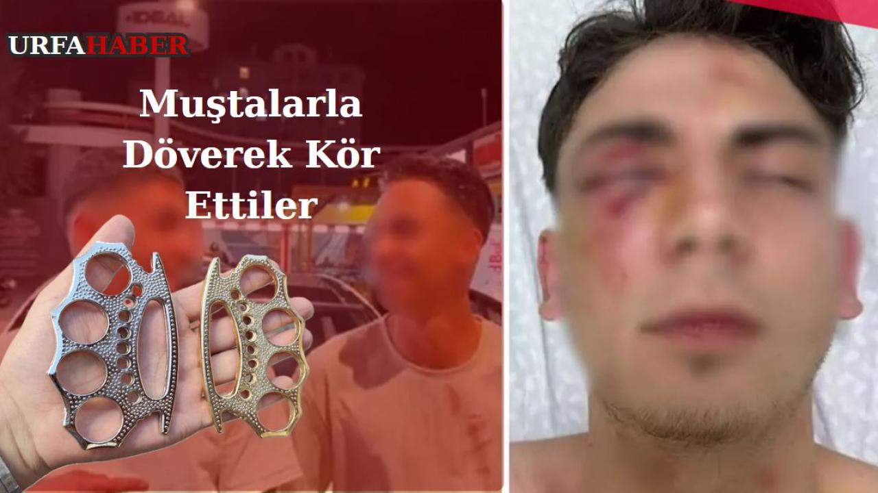 Muştalarla Döverek Kör Ettiler,Şüpheliler Yeniden Gözaltında