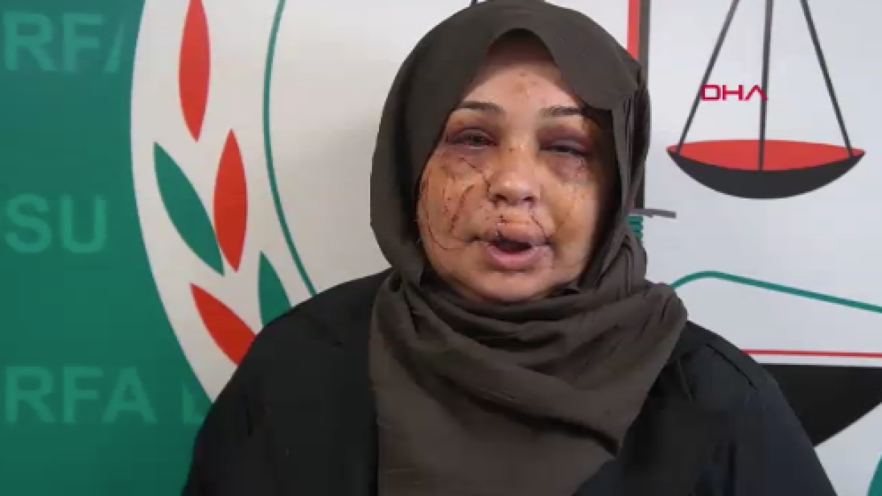 Polis Eşi Tarafından Darp Edildi, Şanlıurfa’ya Sığındı