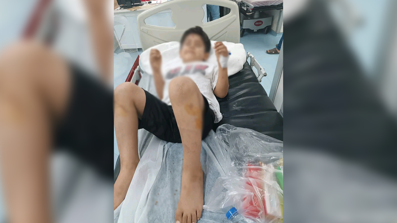 Urfa'da 8 yaşındaki çocuk sokak köpeklerinin saldırısına uğradı!