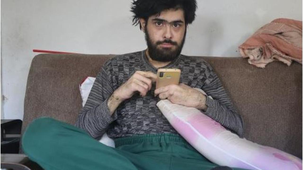3 Yıldır Evden Dışarı Çıkmıyor!