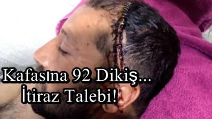 Kafasına 92 Dikiş Atıldı! Karara İtiraz Etti