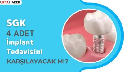 SGK, 4 Adet İmplant Tedavisini Karşılayacak mı?
