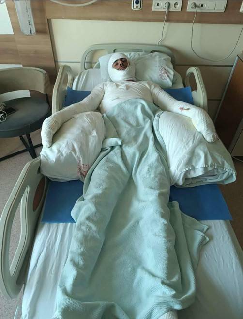 Şanlıurfa’da Tarlada Yangın Faciası: 1 Ağır 5 Yaralı