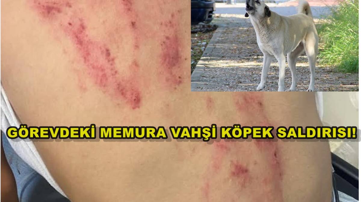 Görevdeki Memura Vahşi Köpek Saldırısı!