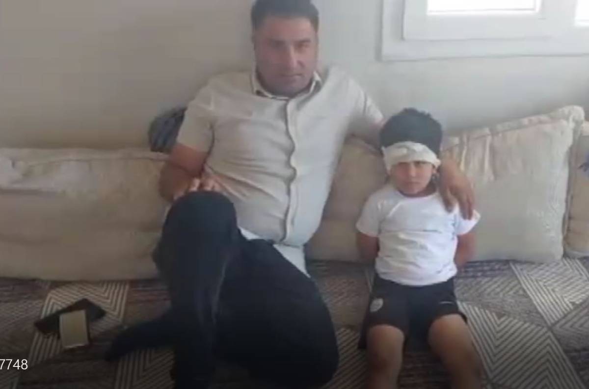Köpeklerin saldırısına uğrayan çocuğu babası kurtardı!